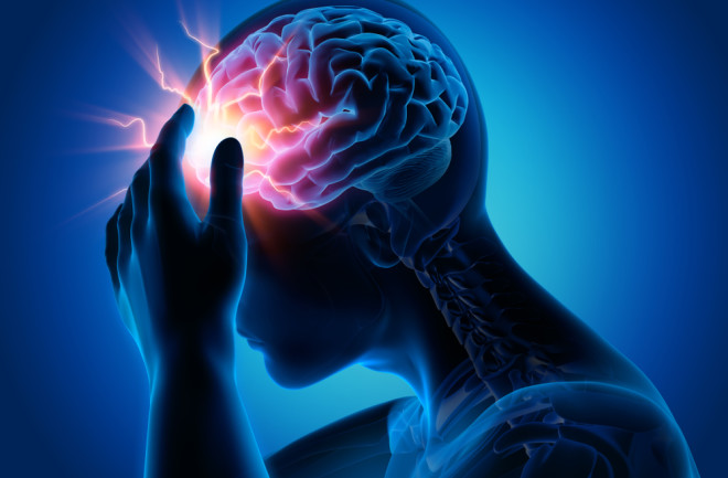 Headache
