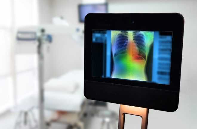 AI Diagnosis Computer Scan COVID-19 - Shutterstock